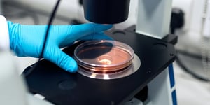 booster-blog-viruses-effect-on-market-petri-dish-microscope-new-zealand
